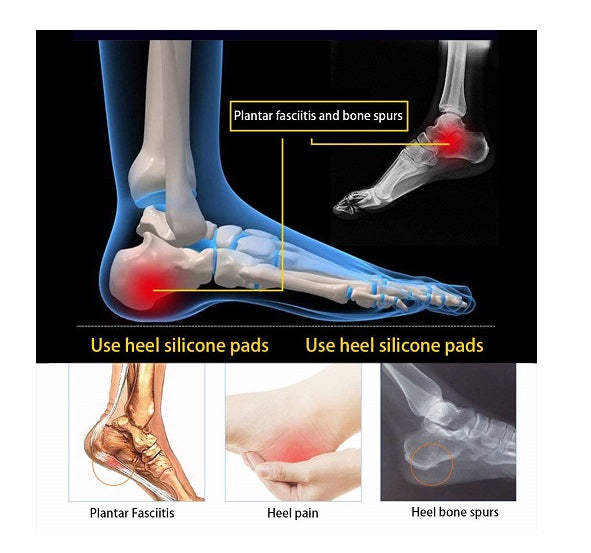 Paire de talon en silicone souple, soulage la douleur au talon, زوج وسادات للكعب الناعمة من السيليكون، تخفف من آلام الكعب تنزوت