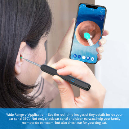 Kit-de-nettoyage-des-oreilles-intelligents-sans-fil-avec-cam-ra-et-lumi-re-LED-NE3.png