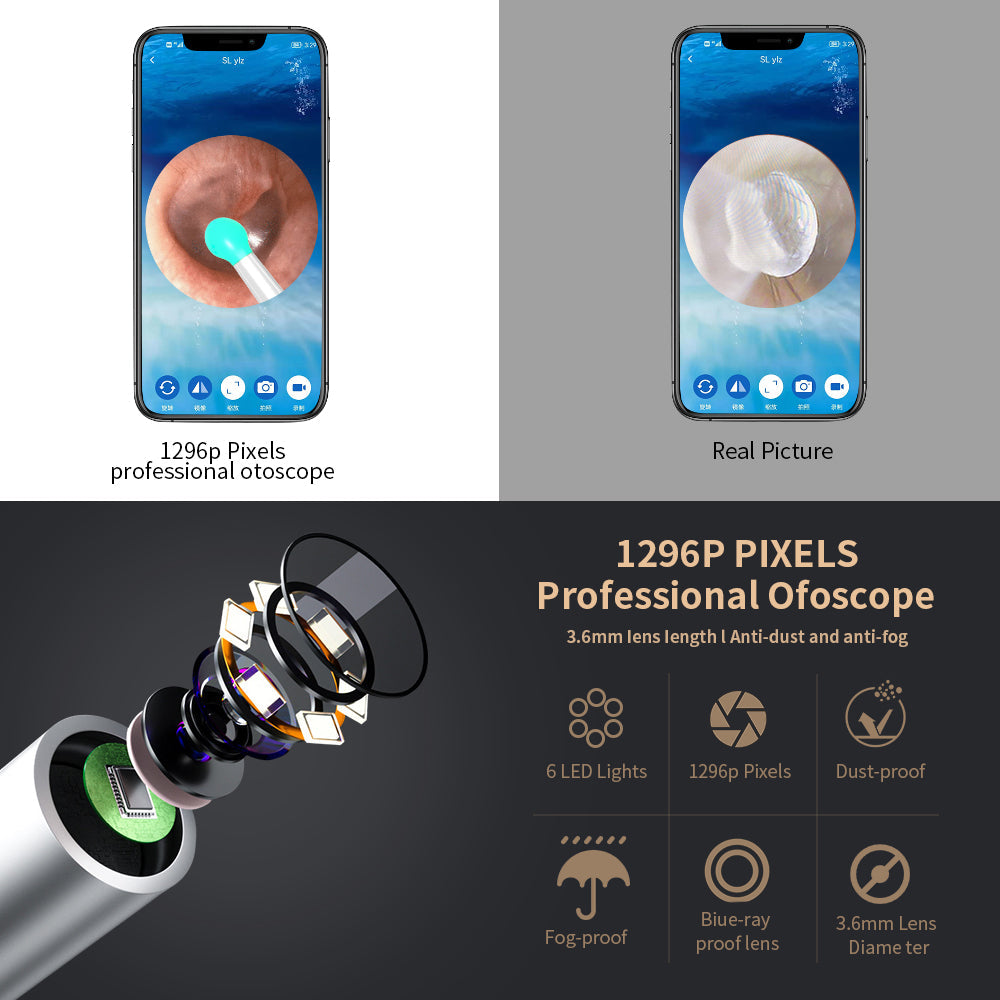 Kit-de-nettoyage-des-oreilles-intelligents-sans-fil-avec-cam-ra-et-lumi-re-LED-NE3.png
