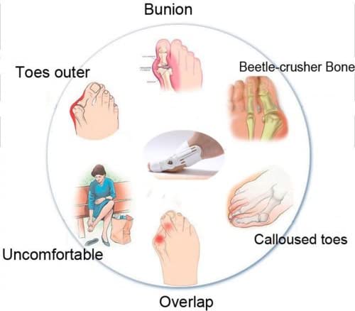 Correcteur Et Ort-hèse De Pied – Blanc تنزوت