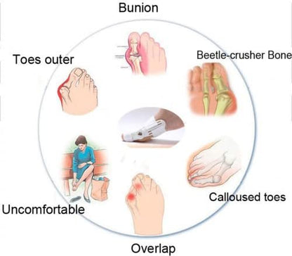 Correcteur Et Ort-hèse De Pied – Blanc تنزوت