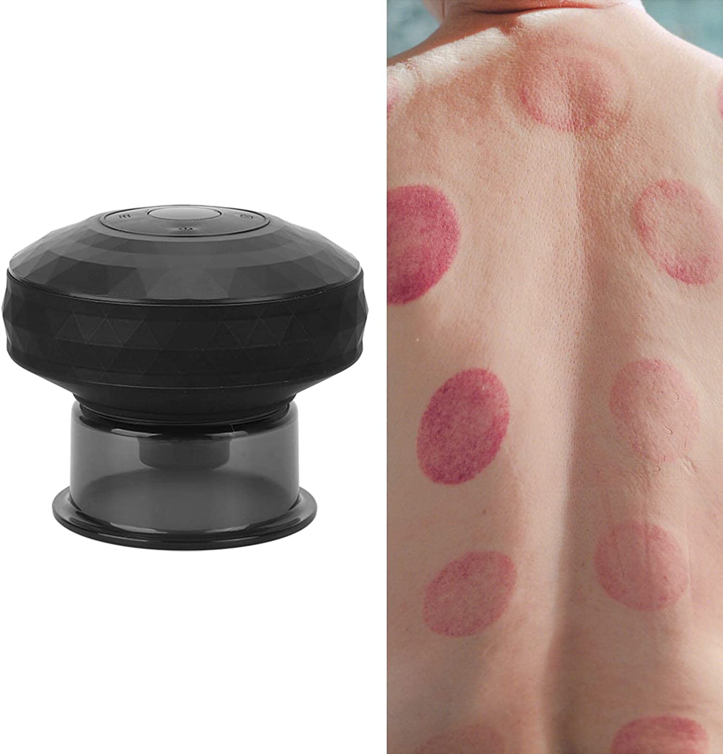 ألة الحجامة الكهربائية للجسم - Ventouse Hijama électrique تنزوت