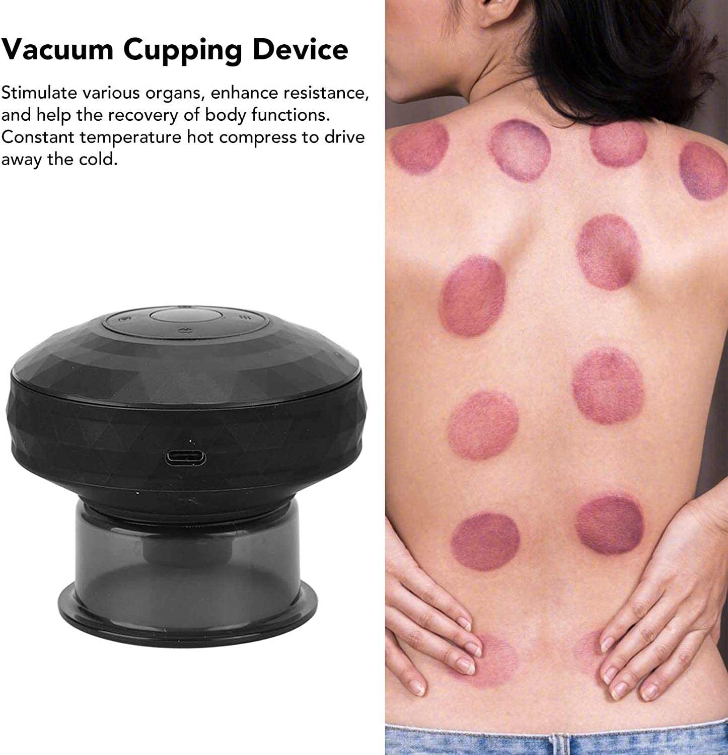 ألة الحجامة الكهربائية للجسم - Ventouse Hijama électrique تنزوت