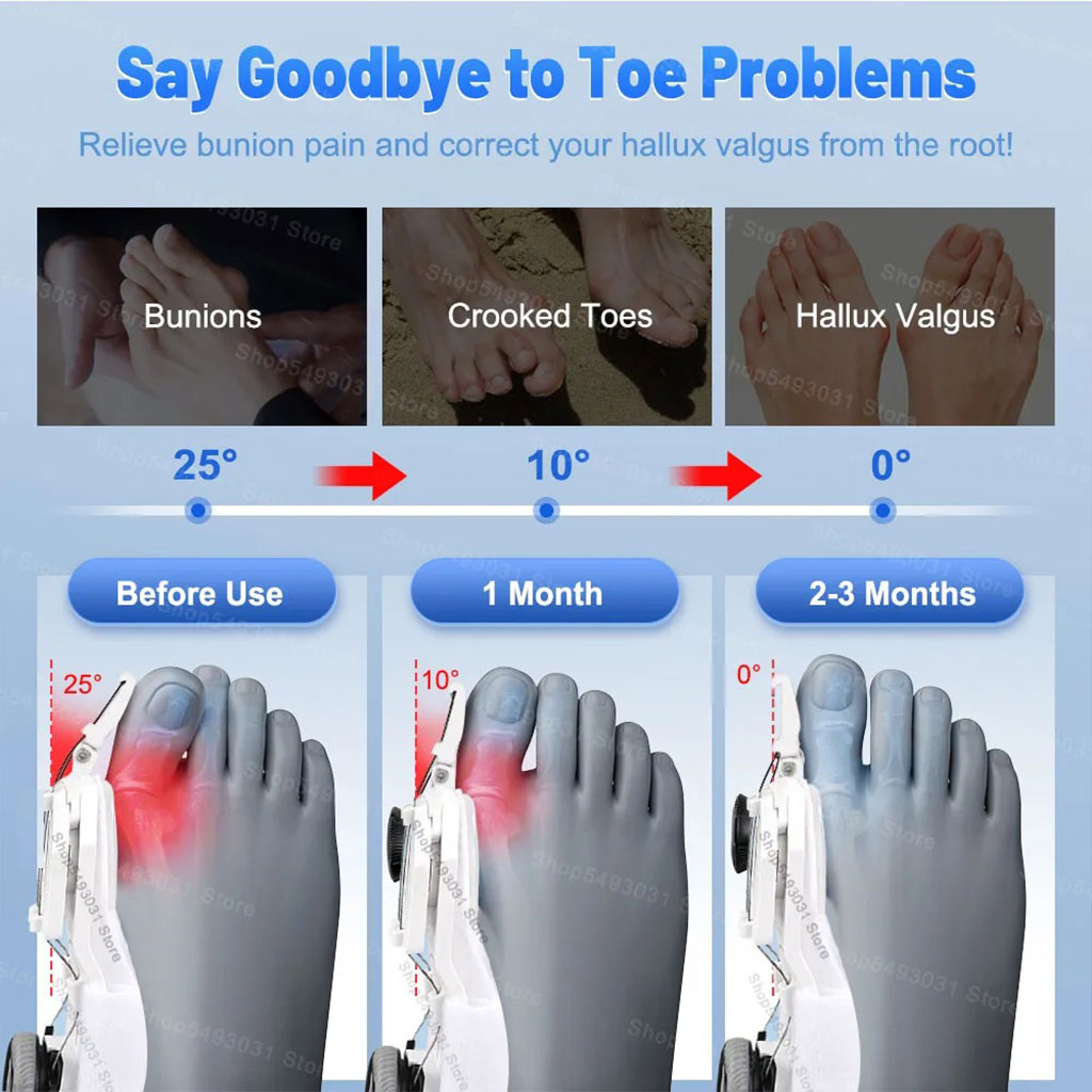 Correcteur-Hallux-Valgus-pour-Femme-et-Homme-avec-Molette-R-glable-مصحح-وضعية-القدم.png