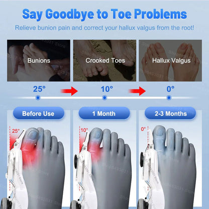 Correcteur-Hallux-Valgus-pour-Femme-et-Homme-avec-Molette-R-glable-مصحح-وضعية-القدم.png