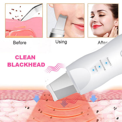 Appareil Ultrasonic purificateur points noir 3en1 lifting-8815 تنزوت