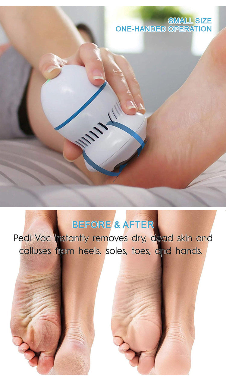 Râpe à Pied et Mains anti-Callosités avec Aspirateur Intégré تنزوت