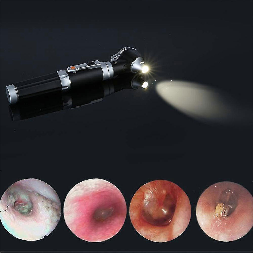 Otoscope-3X-avec-LED-loupe-de-contr-le-d-oreille-portable-avec-8-capuchons-جهاز-فحص-الأذن.png