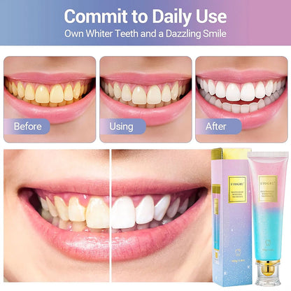 Dentifrice-blanchissant-la-niacinamide-UTOGRU-Triple-action-blanchissante-معجون-تبييض-الأسنان.png